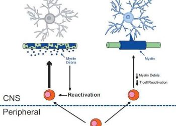 Защита олигодендроцитов может уменьшить развитие рассеянного склероза