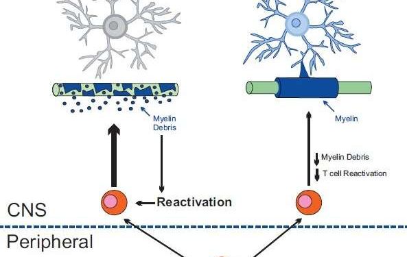 Защита олигодендроцитов может уменьшить развитие рассеянного склероза 1 Защита олигодендроцитов может уменьшить развитие рассеянного склероза