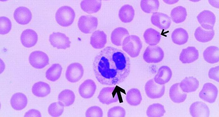 Гранулоцитарный эрлихиоз человека 1 Гранулоцитарный эрлихиоз человека