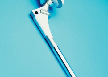 Операции по замене суставов произвели революцию в лечении артрита