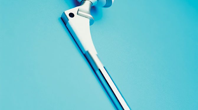 Операции по замене суставов произвели революцию в лечении артрита 1 Операции по замене суставов произвели революцию в лечении артрита