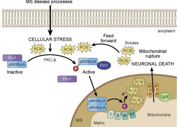 Митохондриальная дисфункция и нейродегенерация при рассеянном склерозе