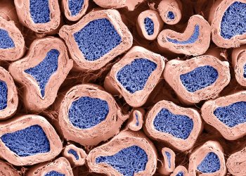 Нейропротекция и усиление ремиелинизации эстрадиолом и дексаметазоном в сокультурах нейронов DRG крысы и клеток Шванна. 3 Нейропротекция и усиление ремиелинизации эстрадиолом и дексаметазоном в сокультурах нейронов DRG крысы и клеток Шванна.