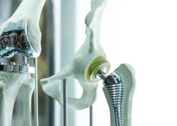 Роботизированная технология для уменьшения послеоперационных осложнений и реадмиссии