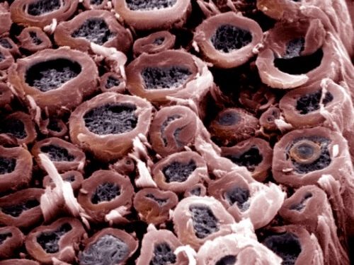 Таурин ускоряет созревание олигодендроцитов