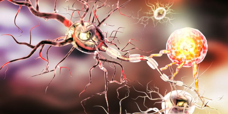 Эпигенетические изменения в иммунных клетках могут стать причиной рассеянного склероза 1 Эпигенетические изменения в иммунных клетках могут стать причиной рассеянного склероза