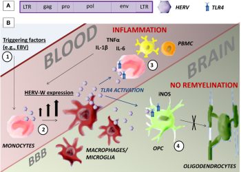 Ученые связывают древние вирусы с хроническим воспалением, вызывающим рассеянный склероз