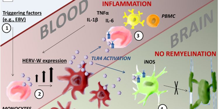 Ученые связывают древние вирусы с хроническим воспалением, вызывающим рассеянный склероз