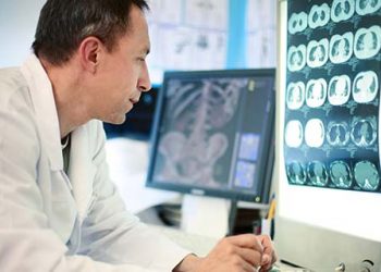 Как диагностируется болезнь Альцгеймера?