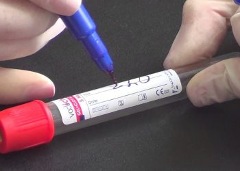 neurofilament light chain NfL