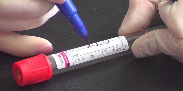 neurofilament light chain NfL