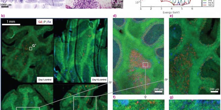 Воспаление увеличивает задержку гадолиния в мозге после введения линейного контрастного вещества на основе гадолиния