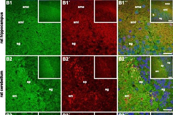 Идентификация гетерокомплекса флотиллин-1/2 как мишени аутоантител при доброкачественном рассеянном склерозе 1 флотиллин