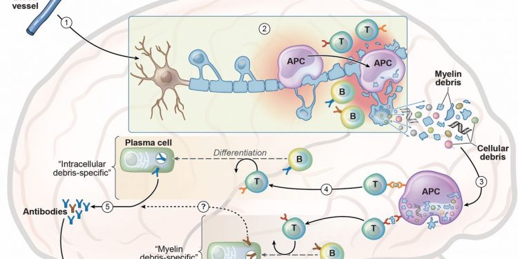 Цель антител при рассеянном склерозе 1 Цель антител при рассеянном склерозе