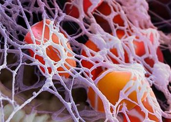 Обнаружили триггер развития рассеянного склероза