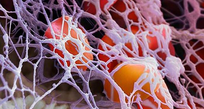 Обнаружили триггер развития рассеянного склероза