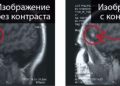Вред контраста мрт, гадолиний откладывается в мозге при раннем рассеянном склерозе.