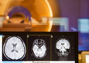 Центральное венозное пятно сохраняет потенциал как диагностический маркер РС