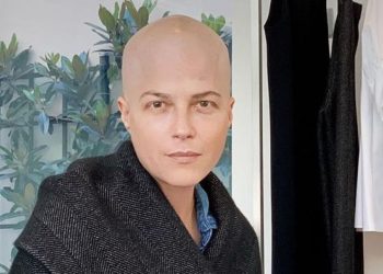 Сельма Блэр говорит, что ее недавняя химиотерапия РС повлияла на ее зрение, способность фокусировать глаза