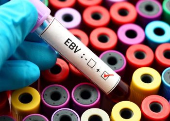 Клеточная иммунотерапия ATA188, показывающая безопасность, намеки на эффективность при прогрессирующем рассеянном склерозе в фазе 1 испытания