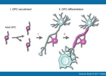 ремиелинизация