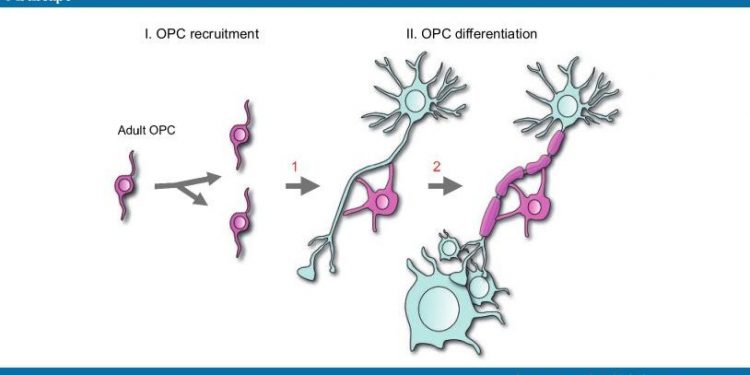 Современные достижения в развитии ремиелинизации при рассеянном склерозе 1 ремиелинизация