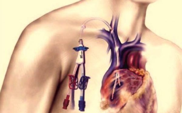 Расписание протокола ведения аТГСК при рассеянном склерозе 1 Расписание протокола ведения аТГСК при рассеянном склерозе