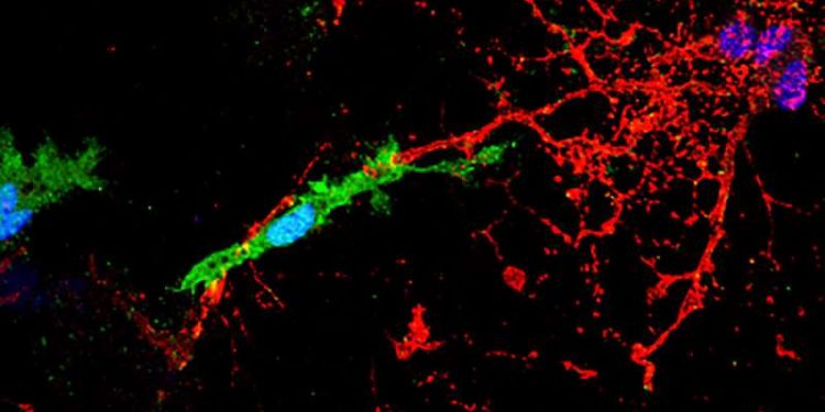 Рассеянный склероз: эндогенный ретровирус HERV-W ключ к повреждению нервной ткани 1 Рассеянный склероз: эндогенный ретровирус HERV-W ключ к повреждению нервной ткани