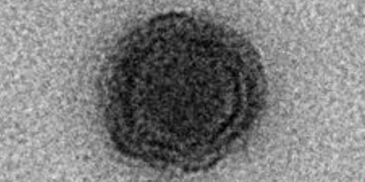 Ученые обнаружили в Бразилии таинственный вирус без известных генов, которые они могли бы идентифицировать 1 Ученые обнаружили в Бразилии таинственный вирус без известных генов, которые они могли бы идентифицировать