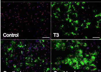 Кветиапин обладает аддитивным действием к трийодтиронину в индукции дифференцировки клеток-предшественников олигодендроцитов посредством индукции биосинтеза холестерина