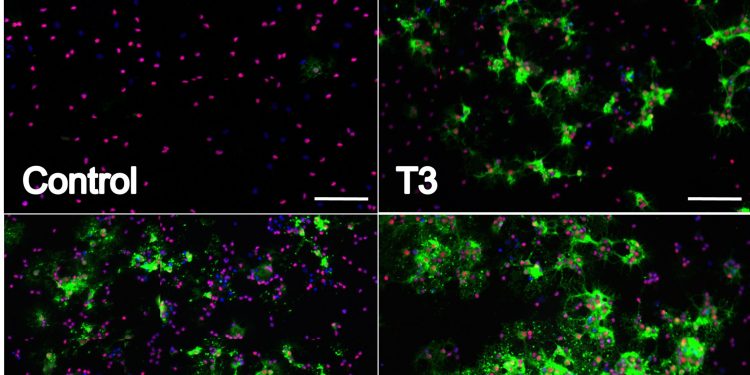 Кветиапин обладает аддитивным действием к трийодтиронину в индукции дифференцировки клеток-предшественников олигодендроцитов посредством индукции биосинтеза холестерина 1 Кветиапин обладает аддитивным действием к трийодтиронину в индукции дифференцировки клеток-предшественников олигодендроцитов посредством индукции биосинтеза холестерина