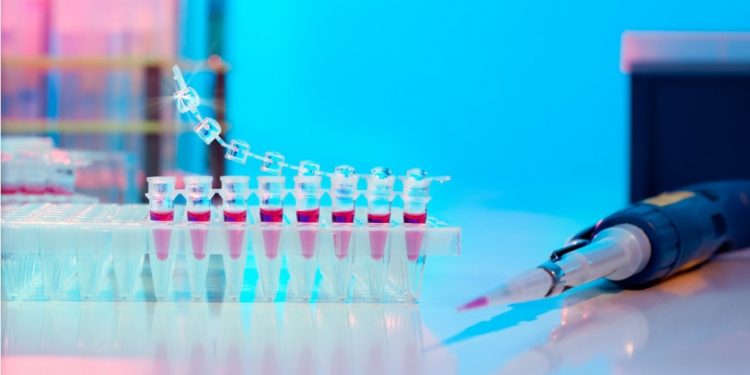 Завершение испытаний клеточной терапии NurOwn для прогрессирующего РС 1 Уровень белка в нервных клетках — как биомаркер травмы головного мозга