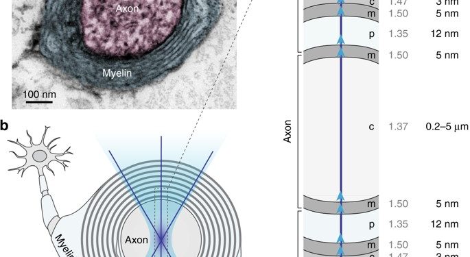 Препарат от эпилепсии может защитить нервы от повреждения при РС 1 Препарат от эпилепсии может защитить нервы от повреждения при РС