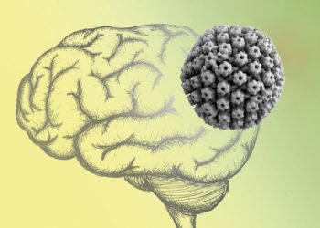 Лечение больных рассеянным склерозом с помощью антигерпесвирусной терапии