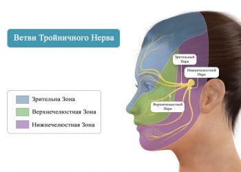 Редкие симптомы рассеянного склероза: что такое невралгия тройничного нерва?