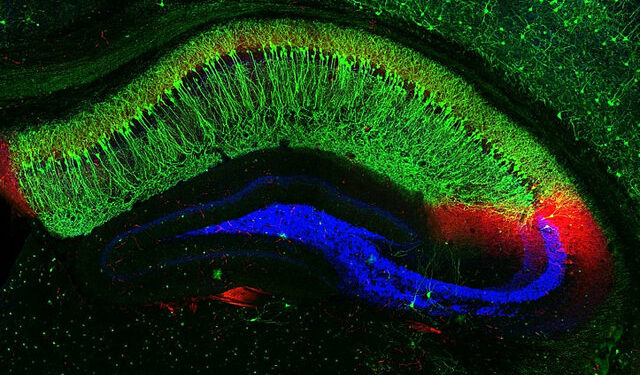 Нейрогенез