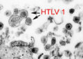 Нейроиммунология миелопатии, ассоциированной с человеческим Т-лимфотропным вирусом типа 1 / тропического спастического парапареза