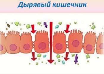 дырявый кишечник рассеянный склероз