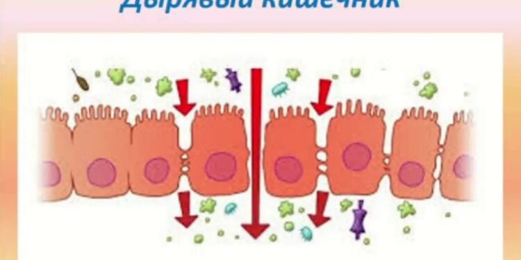 Биомаркеры барьерной функции кишечника при рассеянном склерозе связаны с активностью заболевания 1 дырявый кишечник рассеянный склероз