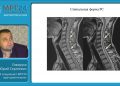 Демиелинизирующие заболевания на МРТ вебинар