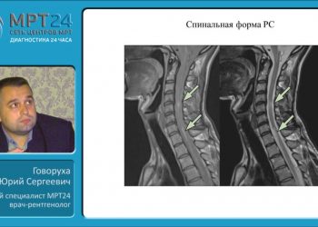 Демиелинизирующие заболевания на МРТ вебинар