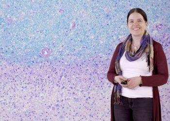 Миелинизация невропатология рассеянного склероза - Кристин Штадельманн