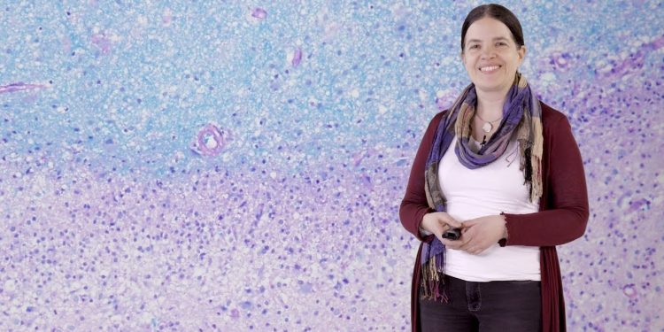 Миелинизация невропатология рассеянного склероза - Кристин Штадельманн 1 Миелинизация невропатология рассеянного склероза - Кристин Штадельманн