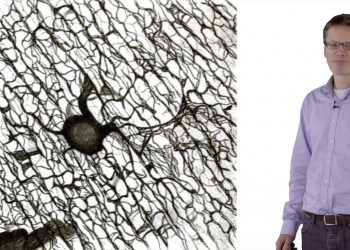 ремиелинизация и рассеянный склероз