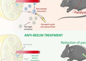 Исследователи нашли новый многообещающий подход к лечению рассеянного склероза