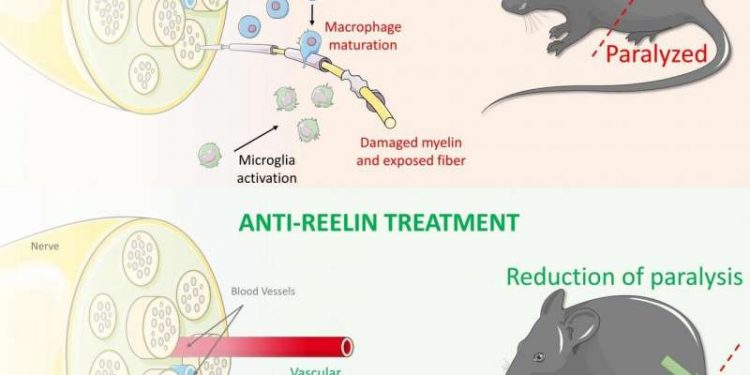 Исследователи нашли новый многообещающий подход к лечению рассеянного склероза