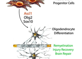 Ремиелинизация, в основном, осуществляется уже существующими миелин-продуцирующими клетками, результаты исследования