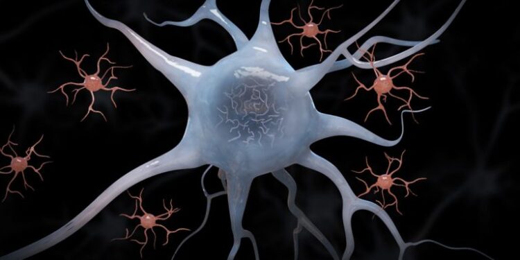 Исследование объясняет процесс, усугубляющий рассеянный склероз. 1 Исследование объясняет процесс, усугубляющий рассеянный склероз.