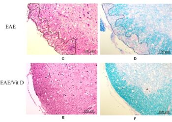 Кальцитриол предотвращает нейровоспаление и снижает нарушение гематоэнцефалического барьера и локальную активацию макрофагов / микроглии