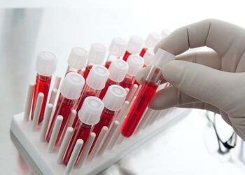 Novartis и Siemens разработают анализы крови на рассеянный склероз